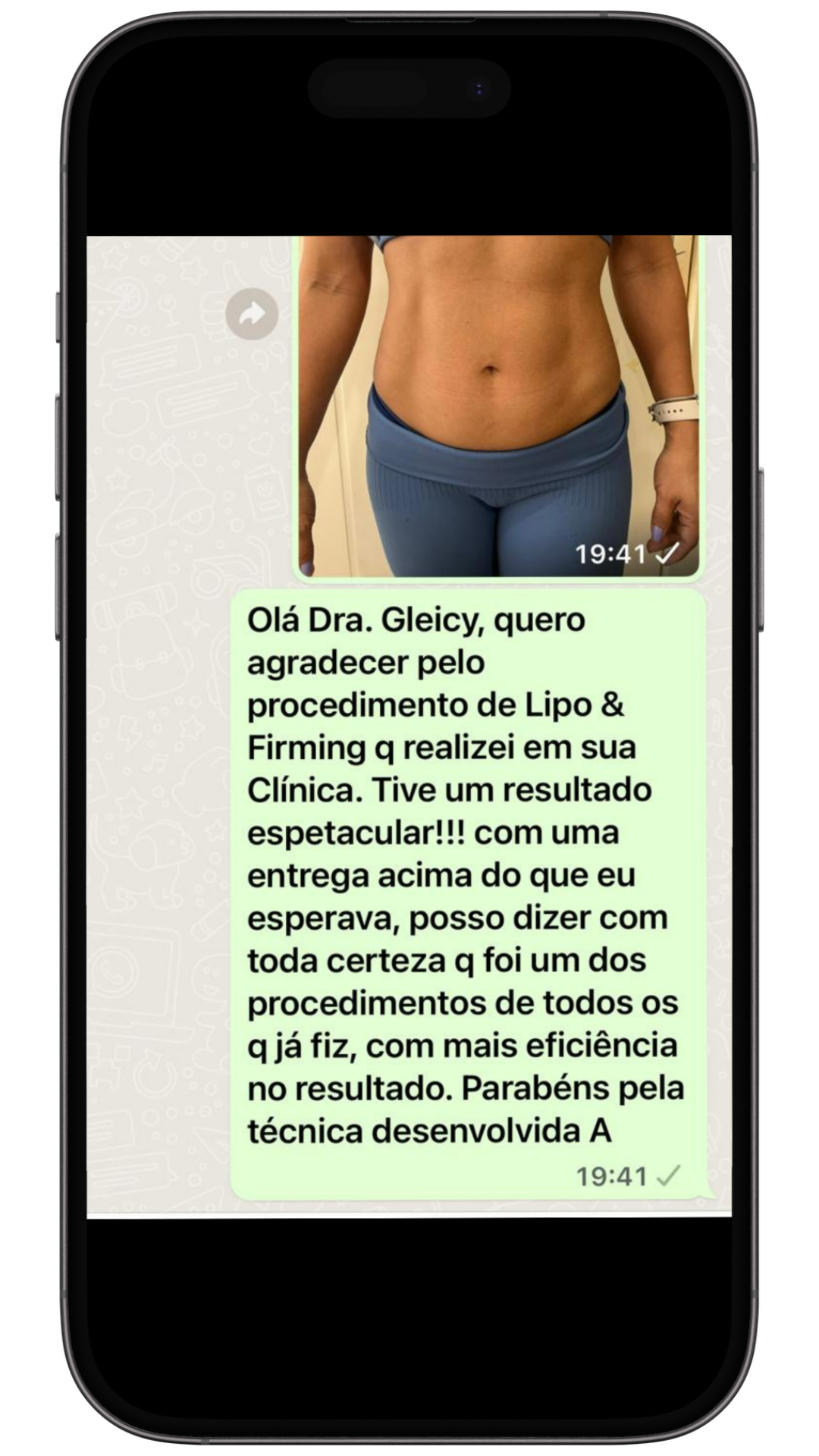 Depoimentos Lipo e Firming (2)